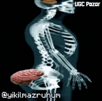Brain Low Iq GIF by UGCPazar