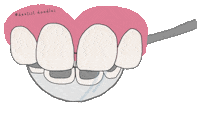 Orthodontics Brackets Sticker