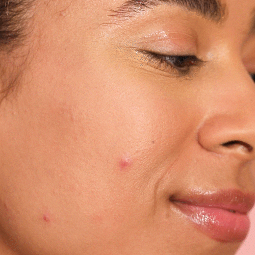 hanhooskin giphyupload skin zit pimple patch GIF