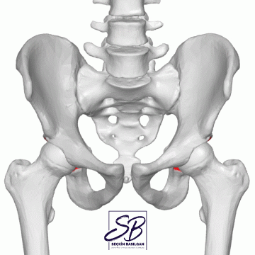 drseckinbasilgan giphyupload hip orthopedics ortopedi GIF
