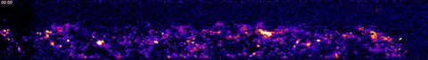 MIMETAS giphyupload science neuroscience seizure GIF
