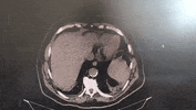 GIF by Imunizadora Hoffmann