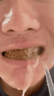 Gif irrigador bucal
