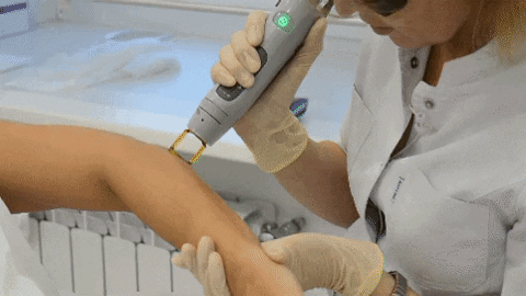 nnwplc giphygifmaker cadela лазерная эпиляция calndela laser GIF