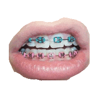 lips braces STICKER by imoji