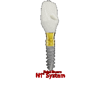 Implant N1 Sticker by takashiuchida