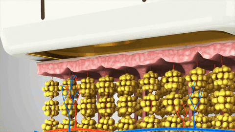 CrystalClinic giphyupload mmfu ultrafomer iii เทคโนโลยกระชบผวหนา GIF