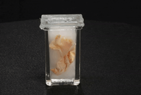 gallbladder GIF by Mütter Museum