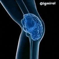 No Brain Low Iq GIF