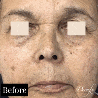 GIF by DermFx