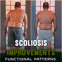 Scoliosis GIF by functionalpatterns