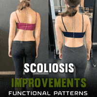 Scoliosis GIF by functionalpatterns