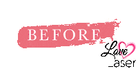Laser Hair Removal Sticker by Love Laser