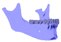 skull teeth Sticker by proj.implanto.ufpel