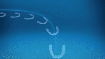 Invisalign GIF