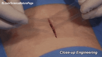 manueloccorso hurt cut stitches biomedical GIF