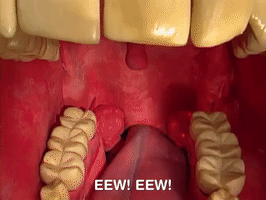 200.gif?cid=fc005b087359f3ebf9659661759f7181bdd9b875c60b7ef7&rid=200.gif&ct=g