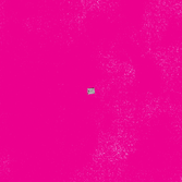 80% of pregnancy related deaths in the US are preventable